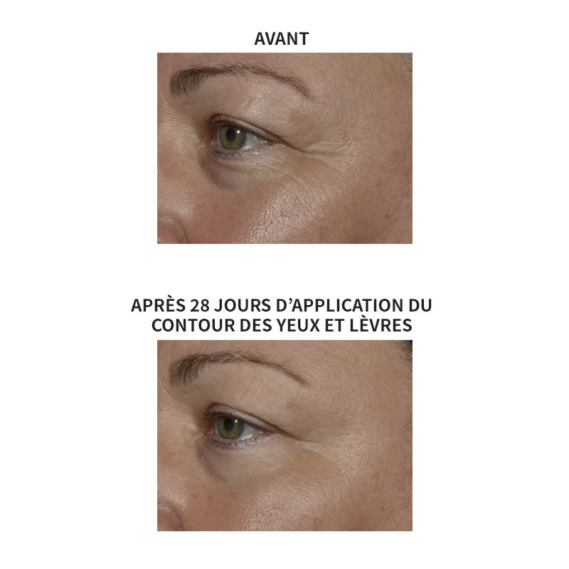 Lys Active Eye Contour & Lip Cream | N-LA05