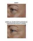 Lys Active® Contour des yeux & lèvres